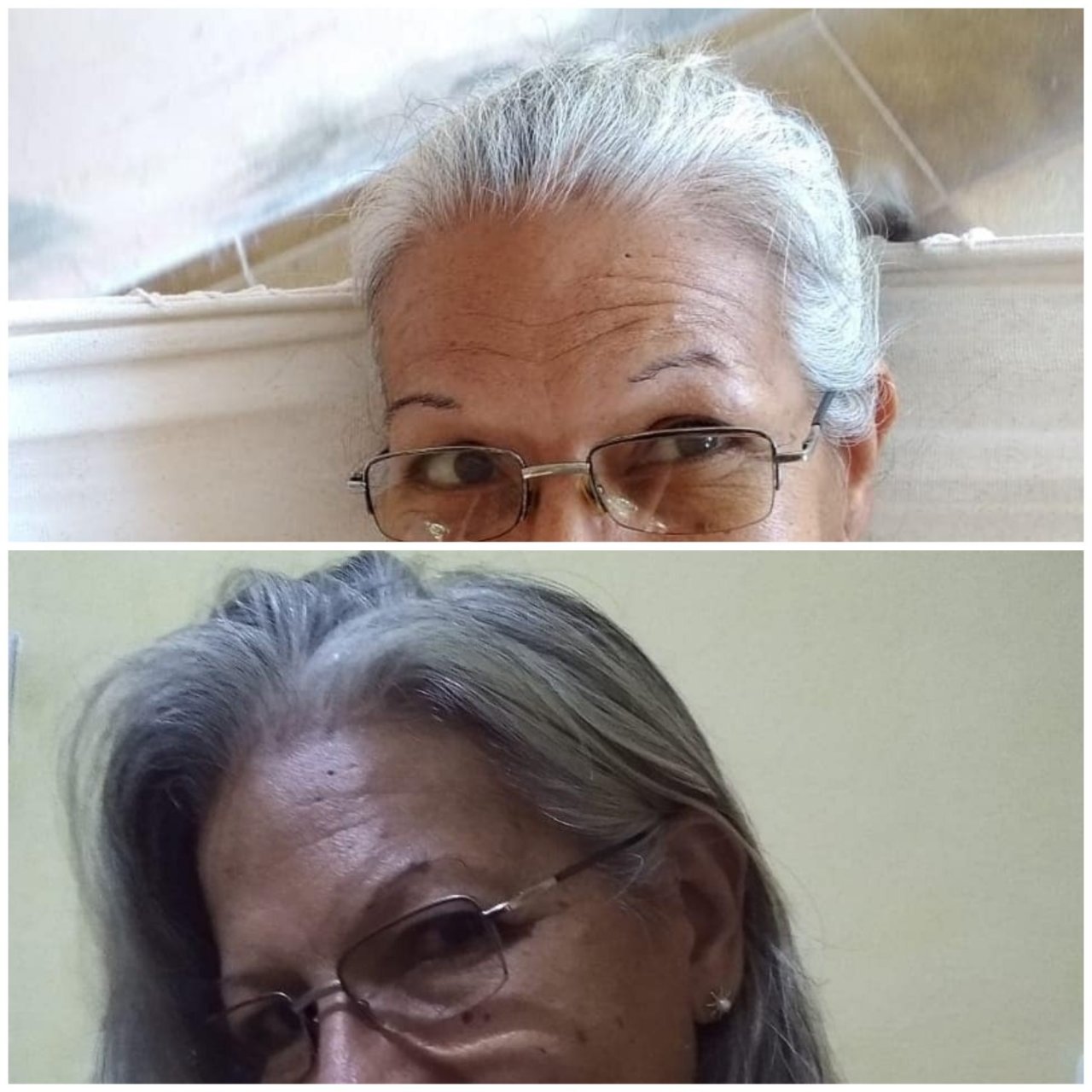 Resultado no cabelo de uma seguidora que usa Metilfolato Premium